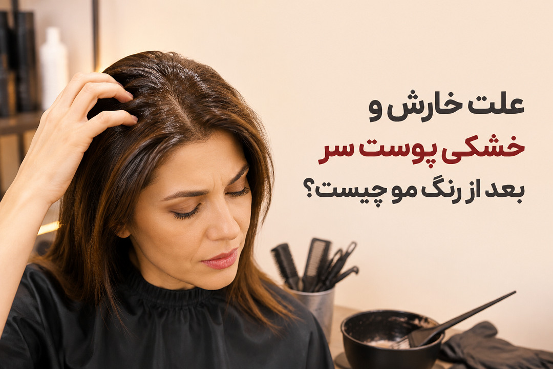 خارش و خشکی پوست سر بعد از رنگ مو